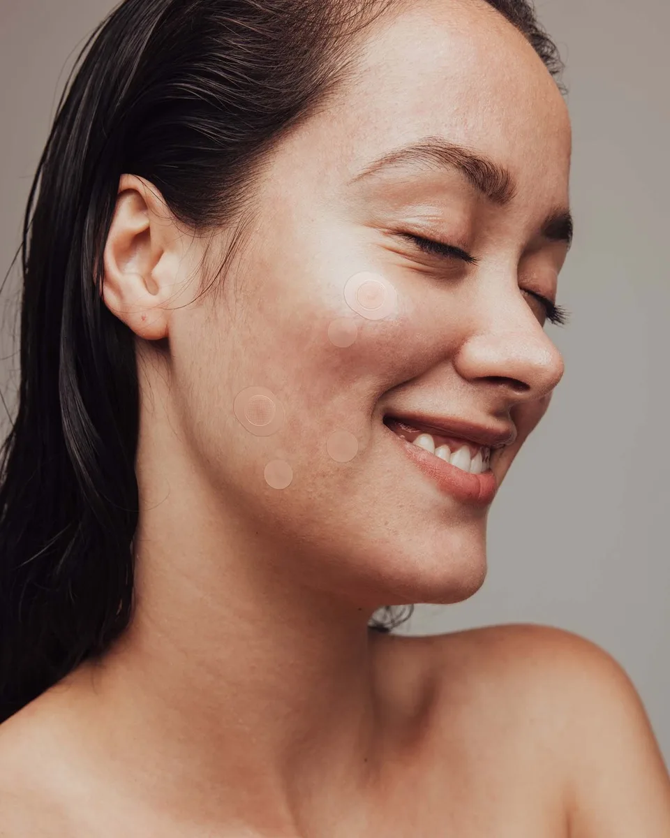 Mujer sonriente con parches hidrocoloides transparentes en la mejilla