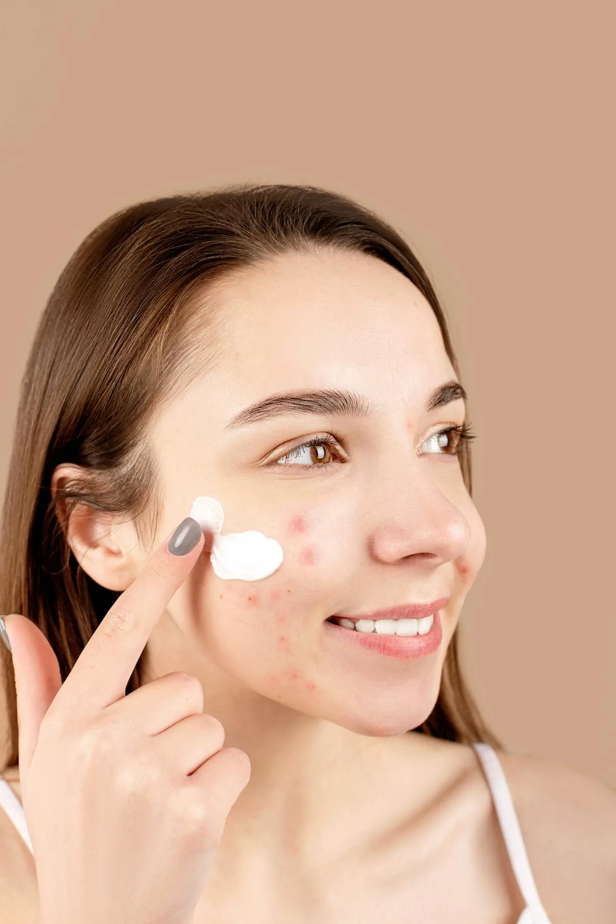 Mujer aplicando crema para acne sonriendo