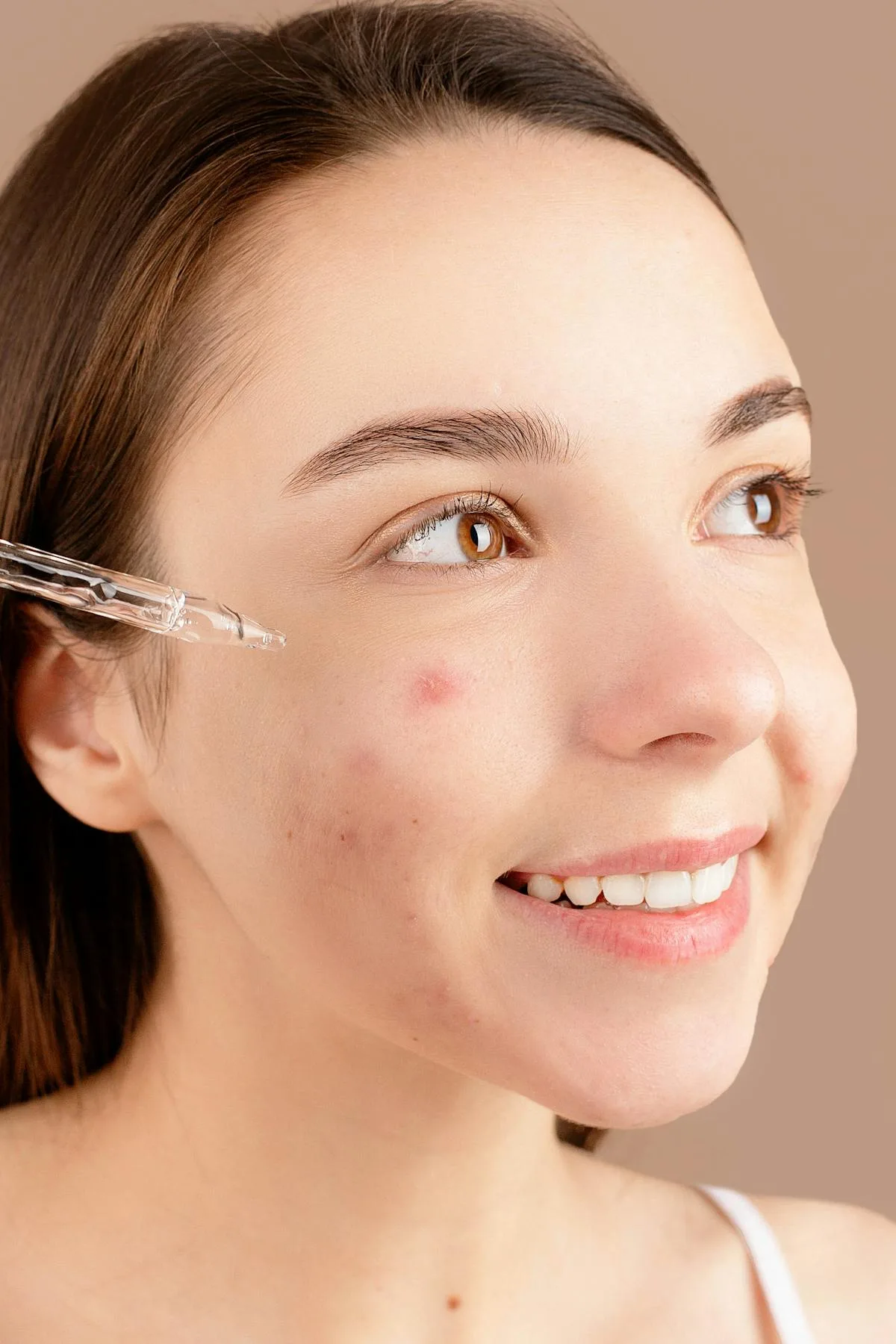 Mujer aplicando serum facial para acne
